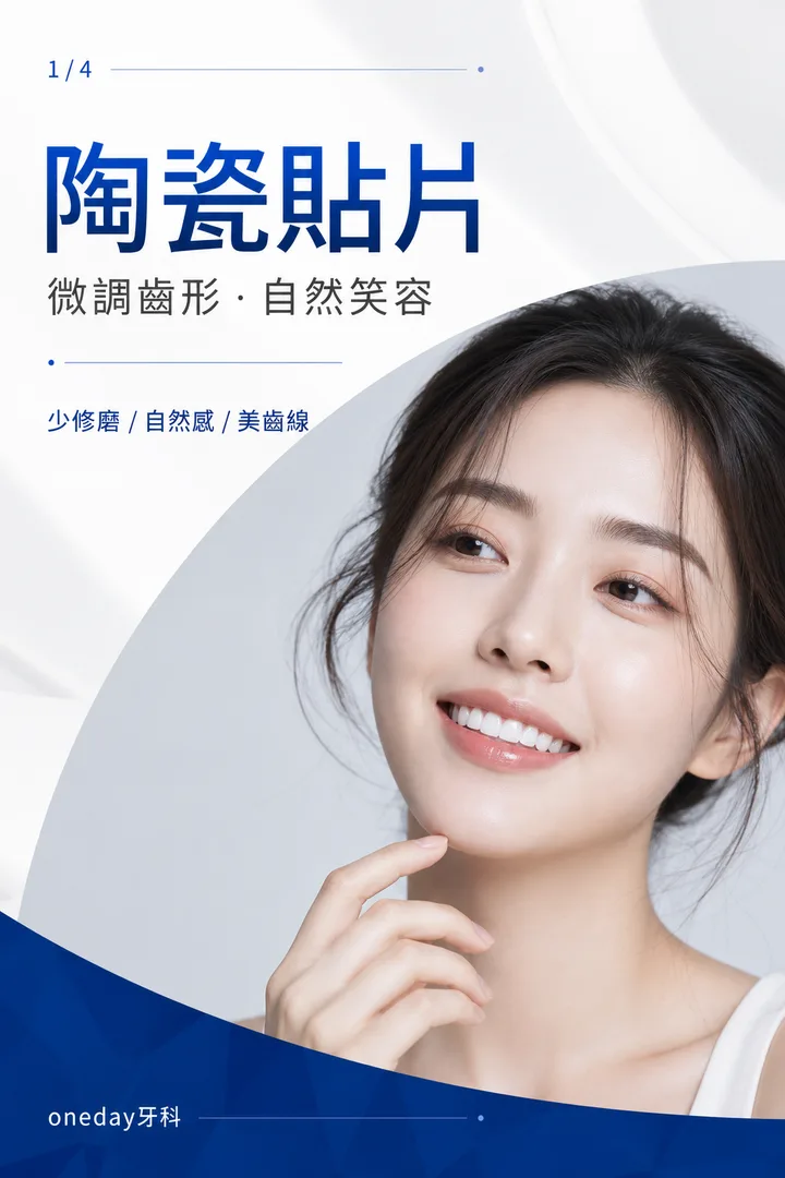 陶瓷貼片・微調齒形