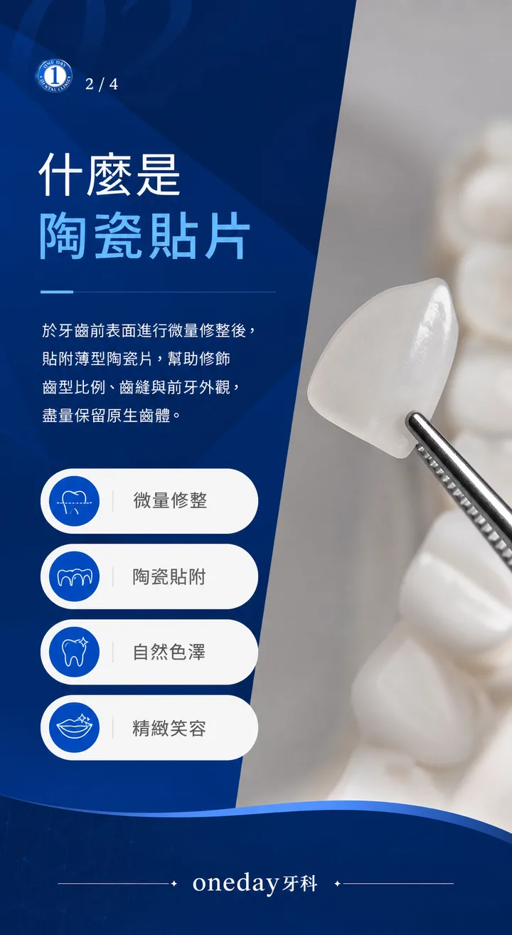什麼是陶瓷貼片