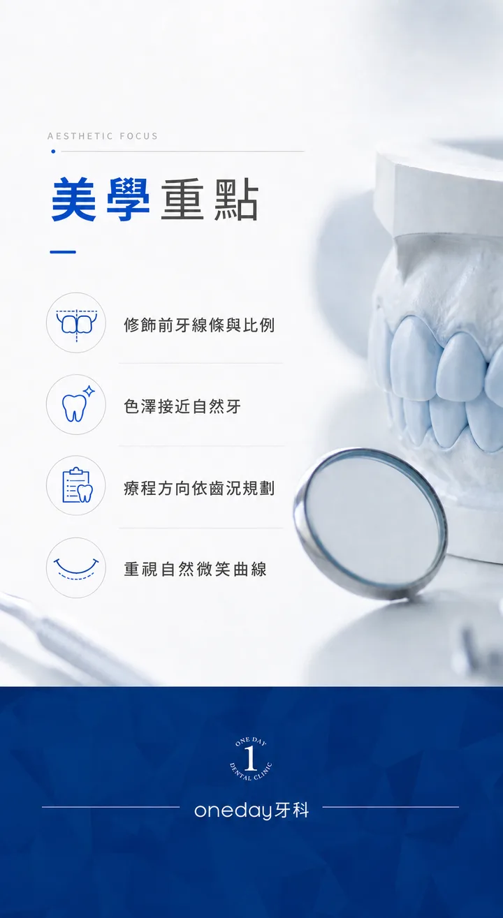 陶瓷貼片美學重點