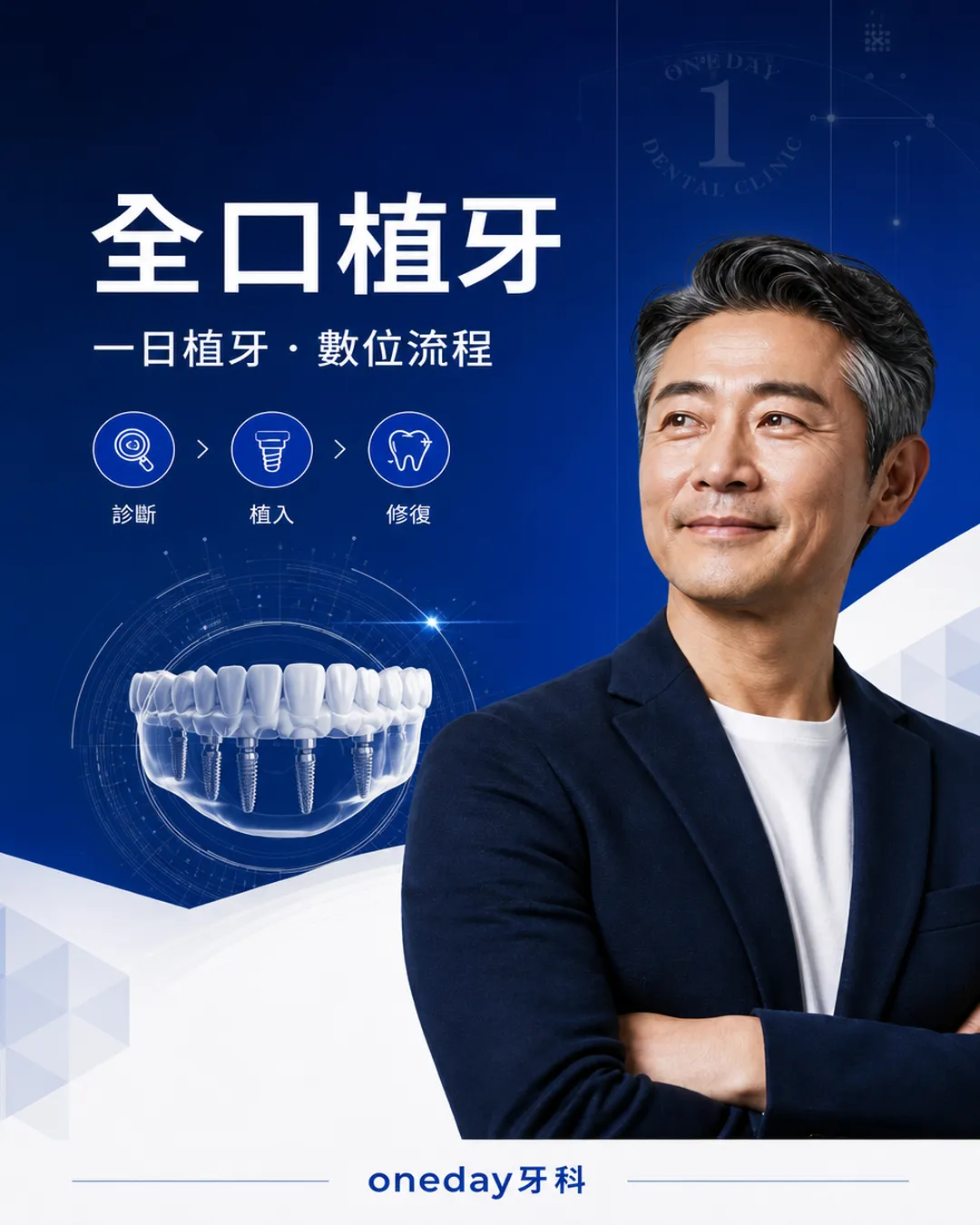 韓國全口植牙 全口重建 數位規劃